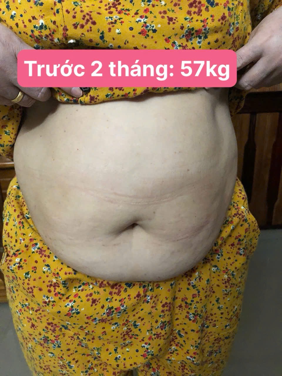 Chị Thuỷ Quảng Nam trước khi dùng Đạm Eo Thon Latuenfit, 57kg