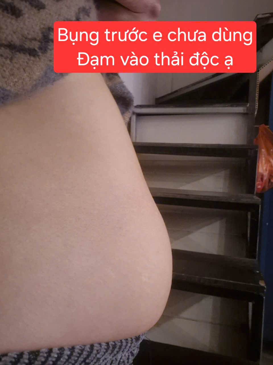 Chị Việt Hoàng trước khi dùng Đạm Eo Thon Latuenfit